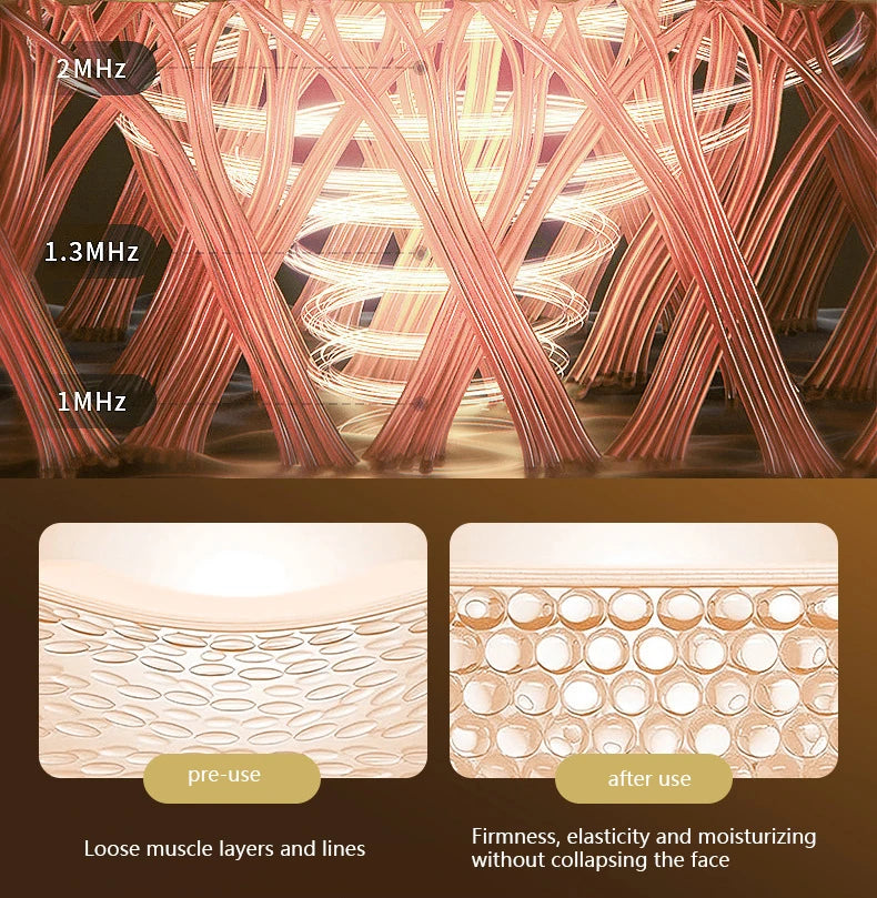 Facial Massager - BEAUTY LIFT